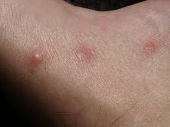 Why You Should See a Elite Dermatology for a Skin Rash