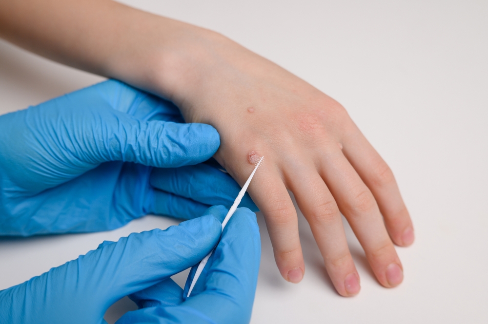 wrinkle treatment tysons va