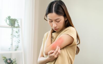 How to Tell the Difference Between Psoriasis and Eczema