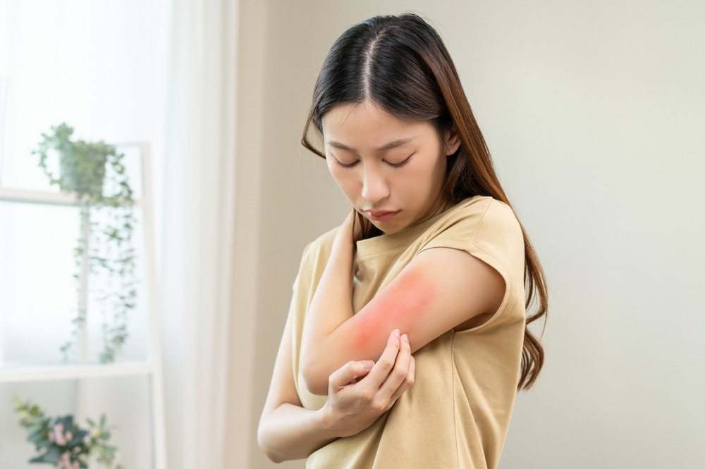 How to Tell the Difference Between Psoriasis and Eczema