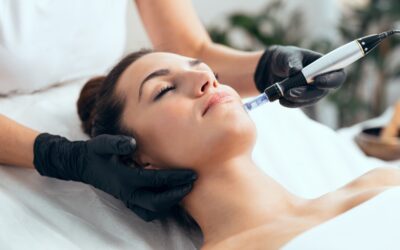 Microneedling Treatment: Establishing General Guidelines for Frequency