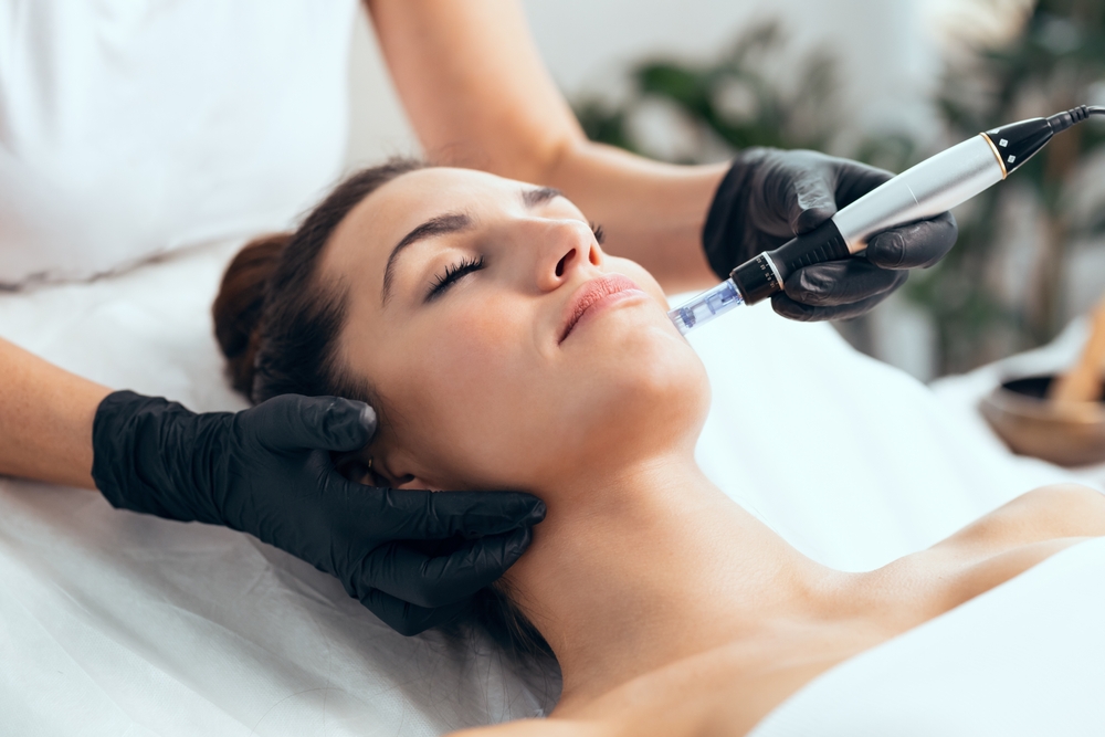 Microneedling Treatment: Establishing General Guidelines for Frequency